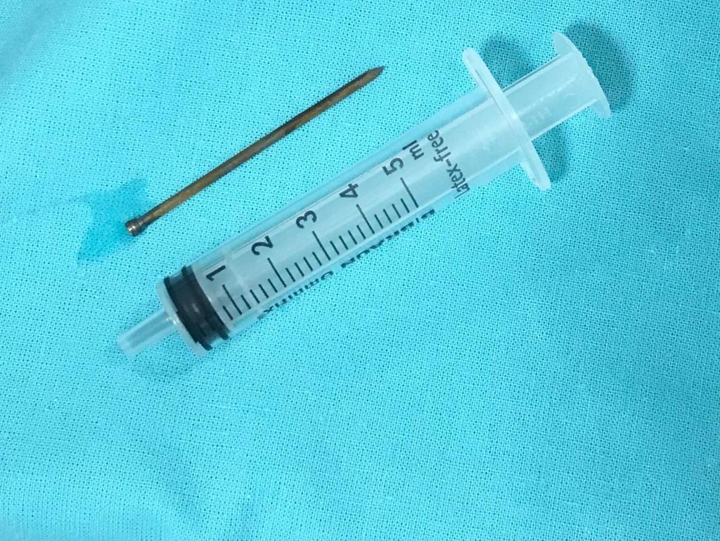 IMG_5463-10-12-18-04-40 ребенок проглотил гвоздь