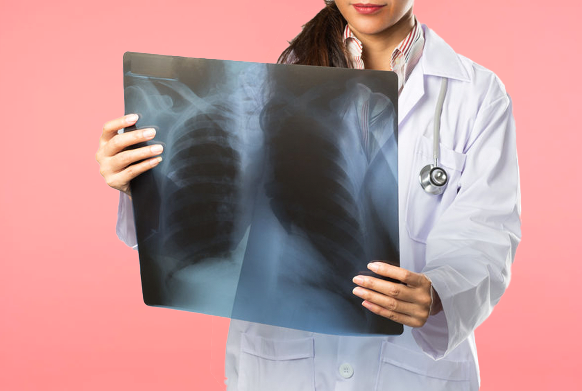 Об осложнениях гриппа_0