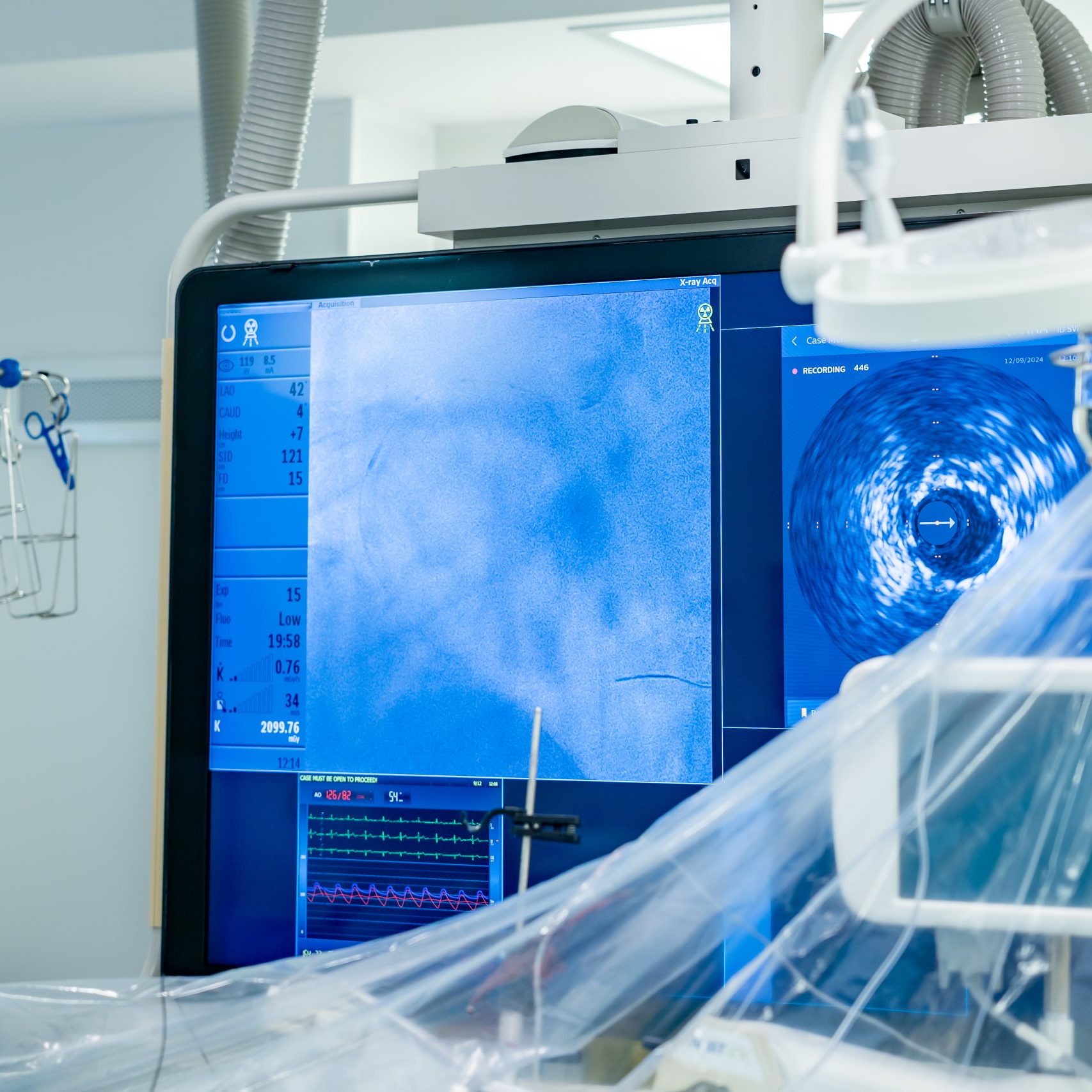 Анастасия Ракова рассказала о внедрении новой технологии для точной визуализации сосудов в Москве