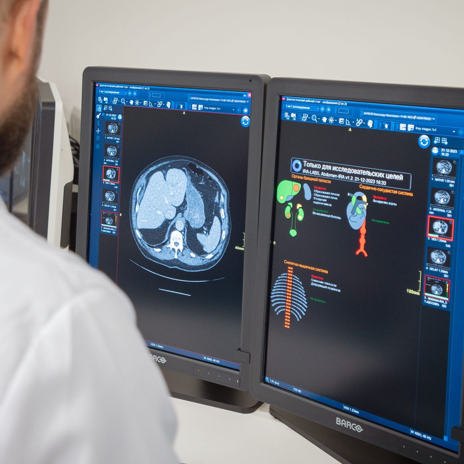 Анастасия Ракова рассказала о расширении направлений использования ИИ в московской медицине