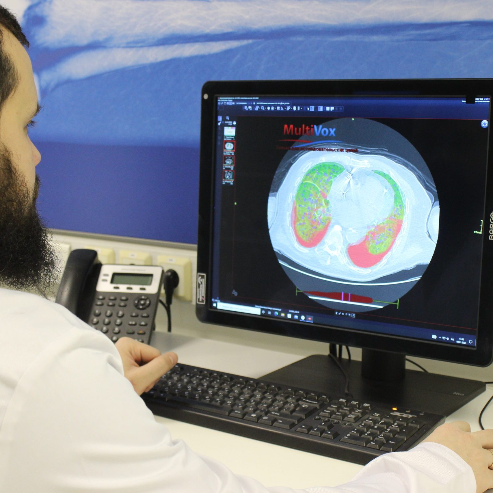 Анастасия Ракова рассказала о расширении направлений использования ИИ в московской медицине